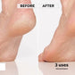 Flawless PediPen ( Salon-At-Home)